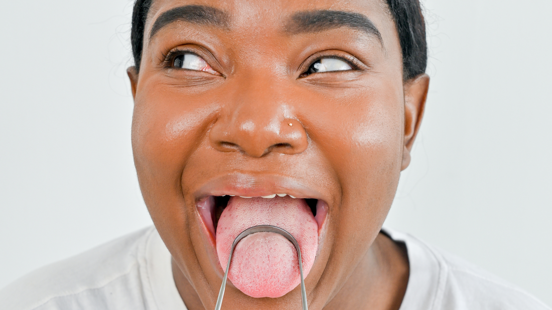 The Link Between Bacteria Buildup on Your Tongue and Bad Breath