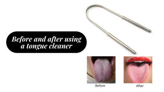 Before and After Using a Tongue Cleaner