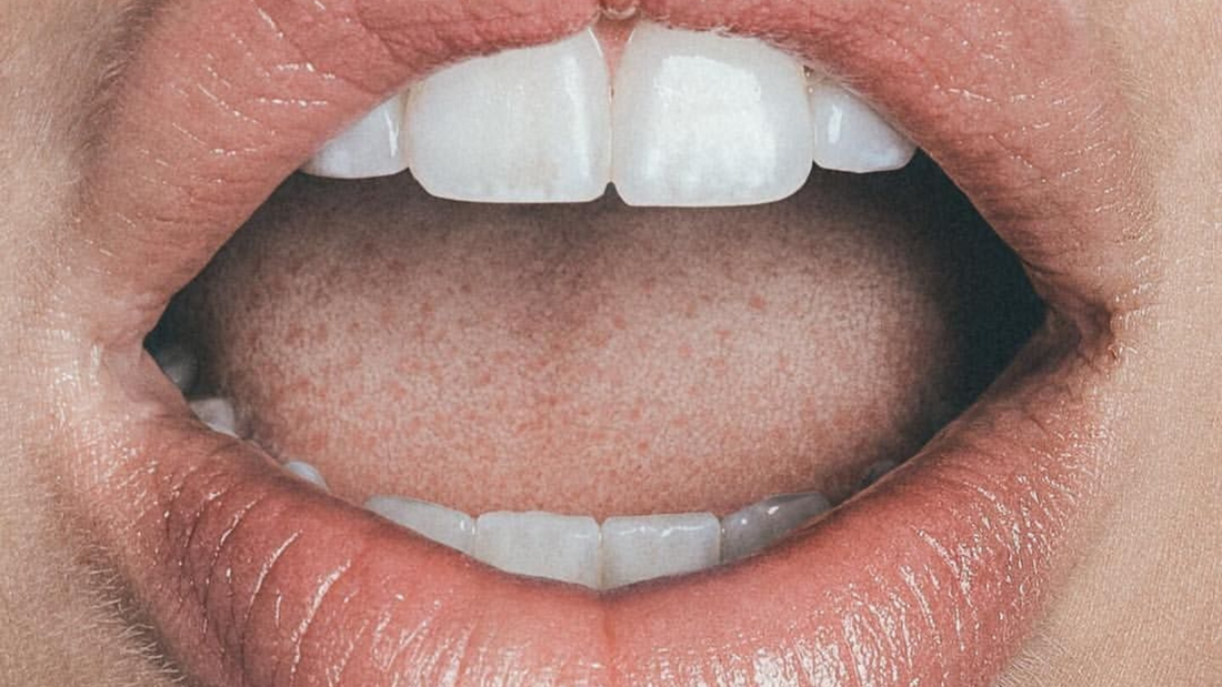 How to always keep your breath fresh: Breath Serum