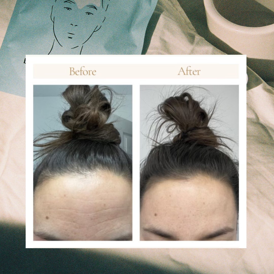 FOREHEAD HALO FACE TAPE